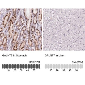 Anti-GALNT7 antibody produced in rabbit Prestige Antibodies&#174; Powered by Atlas Antibodies, affinity isolated antibody, buffered aqueous glycerol solution