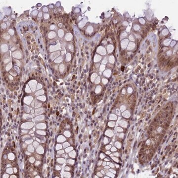 Anti-RBBP8 antibody produced in rabbit Prestige Antibodies&#174; Powered by Atlas Antibodies, affinity isolated antibody, buffered aqueous glycerol solution