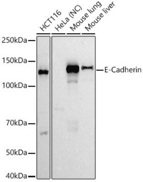 Anti-E-Cadherin Antibody, clone 2Q9Y7, Rabbit Monoclonal