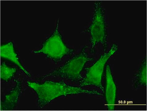 Monoclonal Anti-TBCC antibody produced in mouse clone 3D3, purified immunoglobulin, buffered aqueous solution