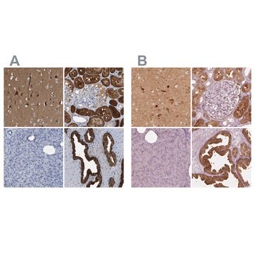 Anti-CRYM antibody produced in rabbit Prestige Antibodies&#174; Powered by Atlas Antibodies, affinity isolated antibody, buffered aqueous glycerol solution