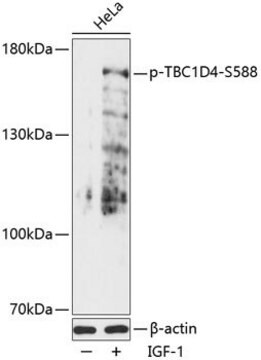 Anti-Phospho-TBC1D4-S588 antibody produced in rabbit