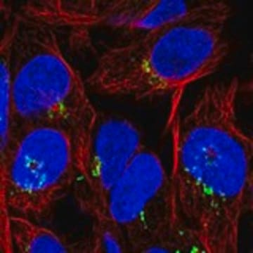 Anti-PDGFA antibody produced in rabbit Prestige Antibodies&#174; Powered by Atlas Antibodies, affinity isolated antibody, buffered aqueous glycerol solution