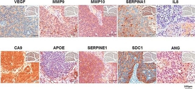 Anti-SERPINE1 antibody produced in rabbit Prestige Antibodies&#174; Powered by Atlas Antibodies, affinity isolated antibody, buffered aqueous glycerol solution