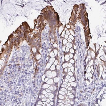 Anti-TAS2R38 antibody produced in rabbit Prestige Antibodies&#174; Powered by Atlas Antibodies, affinity isolated antibody, buffered aqueous glycerol solution