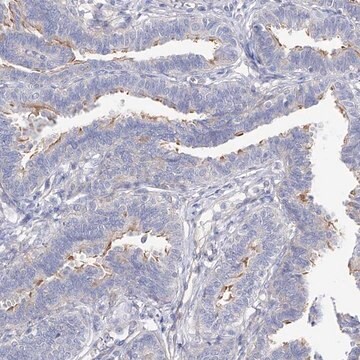 Anti-LCA5 antibody produced in rabbit Prestige Antibodies&#174; Powered by Atlas Antibodies, affinity isolated antibody, buffered aqueous glycerol solution