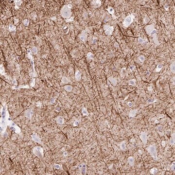 Anti-EMC4 antibody produced in rabbit Prestige Antibodies&#174; Powered by Atlas Antibodies, affinity isolated antibody, buffered aqueous glycerol solution