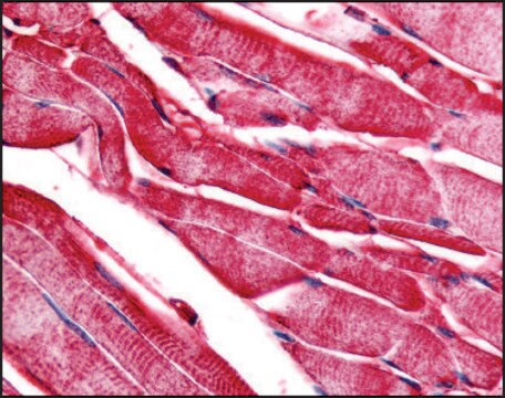 Anti-PYGM antibody produced in rabbit affinity isolated antibody, buffered aqueous solution