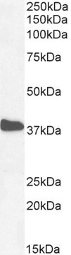 Anti-NKX2-5 antibody produced in goat affinity isolated antibody, buffered aqueous solution