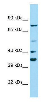 Anti-PAX2 antibody produced in rabbit affinity isolated antibody