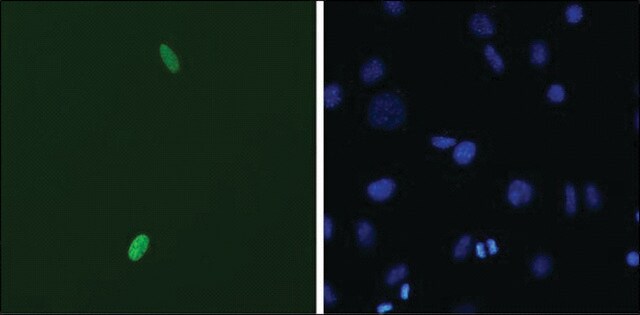 Monoclonal Anti-DUX4 antibody produced in mouse clone P2B1, 1&#160;mg/mL, purified immunoglobulin