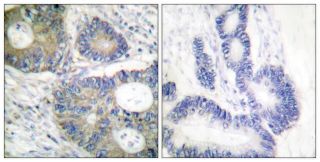 Anti-4E-BP1 antibody produced in rabbit affinity isolated antibody