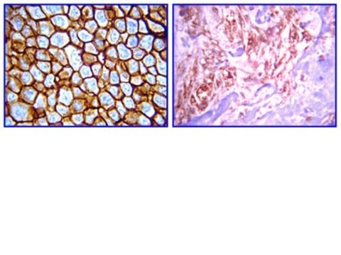 Anti-erbB4 Antibody, clone HFR1/2G4 clone HFR1/2G4, from mouse