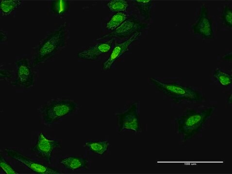 Anti-MPHOSPH8 antibody produced in mouse purified immunoglobulin, buffered aqueous solution