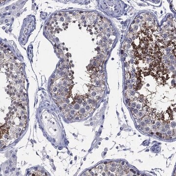 Anti-Akap3 Antibody Produced In Rabbit Prestige Antibodies&#174; Powered by Atlas Antibodies, affinity isolated antibody, buffered aqueous glycerol solution