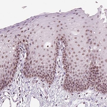 Anti-DDX50 antibody produced in rabbit Prestige Antibodies&#174; Powered by Atlas Antibodies, affinity isolated antibody