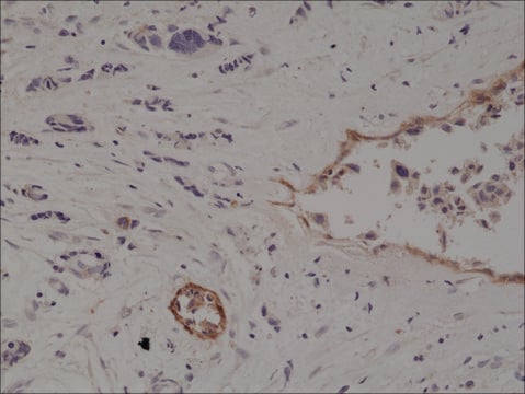 Anti-CD10 antibody, Rabbit monoclonal recombinant, expressed in HEK 293 cells, clone RM337, purified immunoglobulin