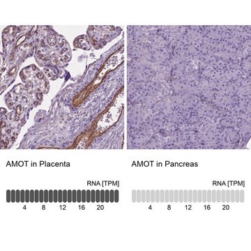 Anti-AMOT antibody produced in rabbit Prestige Antibodies&#174; Powered by Atlas Antibodies, affinity isolated antibody, buffered aqueous glycerol solution