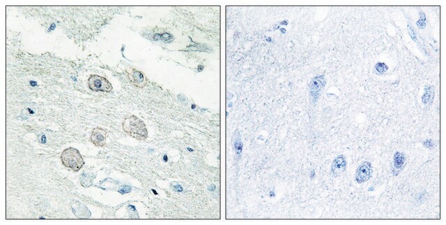 Anti-JAK1 antibody produced in rabbit affinity isolated antibody