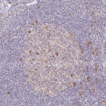 Anti-DERL2 antibody produced in rabbit Prestige Antibodies&#174; Powered by Atlas Antibodies, affinity isolated antibody, buffered aqueous glycerol solution