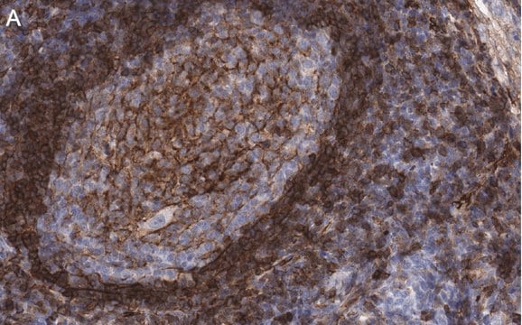 Anti-CD73 (NT5E) Antibody, clone 1F22 ZooMAb&#174; Rabbit Monoclonal recombinant, expressed in HEK 293 cells