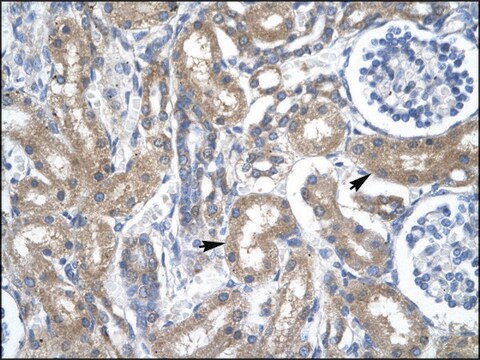 Anti-TFDP2 antibody produced in rabbit IgG fraction of antiserum