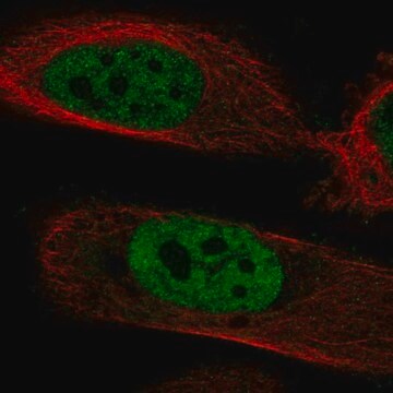 Anti-Polm Antibody Produced In Rabbit Prestige Antibodies&#174; Powered by Atlas Antibodies, affinity isolated antibody, buffered aqueous glycerol solution