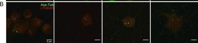 Anti-Tubulin Antibody, Detyrosinated Chemicon&#174;, from rabbit