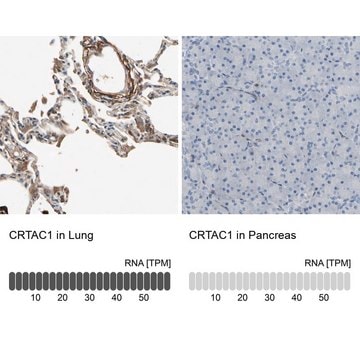 Anti-CRTAC1 antibody produced in rabbit Prestige Antibodies&#174; Powered by Atlas Antibodies, affinity isolated antibody, buffered aqueous glycerol solution