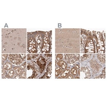 Anti-CEP350 antibody produced in rabbit Prestige Antibodies&#174; Powered by Atlas Antibodies, affinity isolated antibody, buffered aqueous glycerol solution, ab1