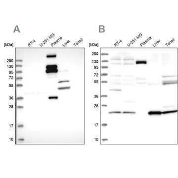 Anti-REXO1 antibody produced in rabbit Prestige Antibodies&#174; Powered by Atlas Antibodies, affinity isolated antibody, buffered aqueous glycerol solution