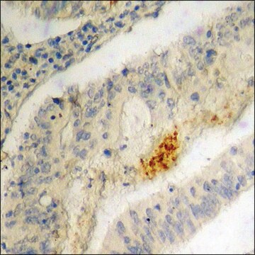 抗-磷酸IRF-3 (pSer396) 兔抗 affinity isolated antibody