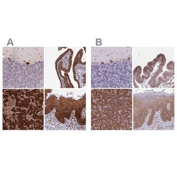 Anti-RPL8 antibody produced in rabbit Prestige Antibodies&#174; Powered by Atlas Antibodies, affinity isolated antibody, buffered aqueous glycerol solution