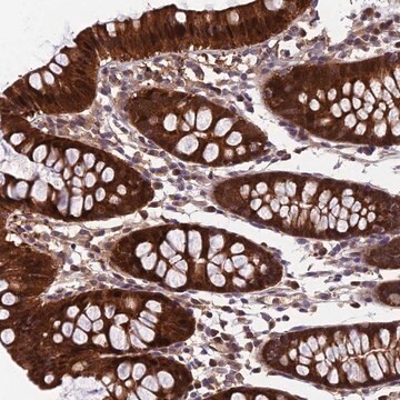 Anti-CCDC15 antibody produced in rabbit Prestige Antibodies&#174; Powered by Atlas Antibodies, affinity isolated antibody, buffered aqueous glycerol solution