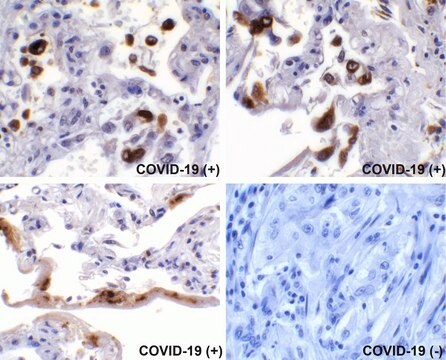 Spike anty-SARS-CoV-2(COVID-19) affinity isolated antibody