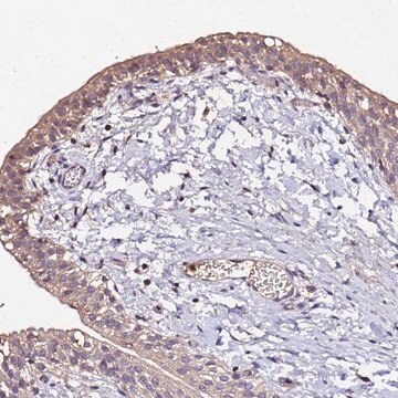 Anti-MTERF1 antibody produced in rabbit Prestige Antibodies&#174; Powered by Atlas Antibodies, affinity isolated antibody, buffered aqueous glycerol solution