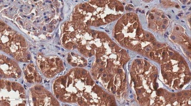 Anti-Polycystin-1 Antibody, clone E4 (5F4D2) clone E4 (5F4D2), from mouse