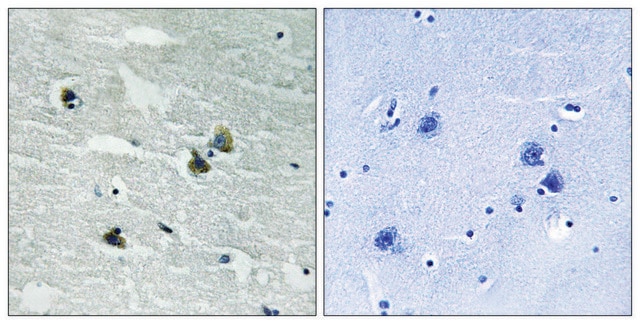 Anti-phospho-MER/SKY (pTyr749/681) antibody produced in rabbit affinity isolated antibody