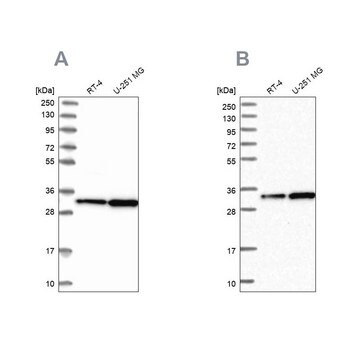 Anti-TBCB antibody produced in rabbit Prestige Antibodies&#174; Powered by Atlas Antibodies, affinity isolated antibody, buffered aqueous glycerol solution