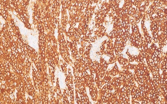 Tyrosine Hydroxylase (LNC1) Mouse Monoclonal Antibody