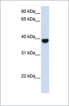 Anti-FOXE1 antibody produced in rabbit affinity isolated antibody