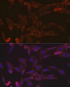 Anti-Inhibin beta A (INHBA) Antibody, clone 1X6N9, Rabbit Monoclonal