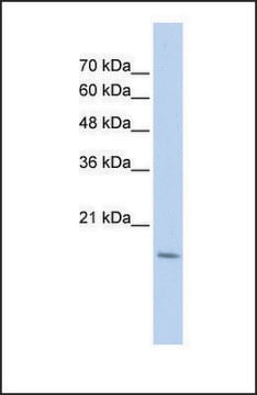 Anti-CDC42EP5 antibody produced in rabbit affinity isolated antibody