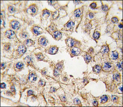 Anti-EPHA10 (center) antibody produced in rabbit saturated ammonium sulfate (SAS) precipitated, buffered aqueous solution