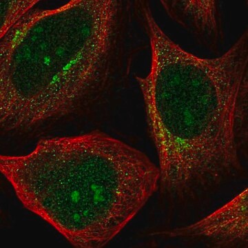 Anti-PDK1 antibody produced in rabbit Prestige Antibodies&#174; Powered by Atlas Antibodies, affinity isolated antibody