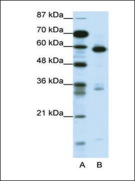 Anti-MBD1 antibody produced in rabbit IgG fraction of antiserum