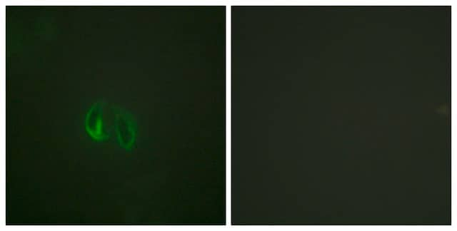 Anti-IL-10R &#945; antibody produced in rabbit affinity isolated antibody