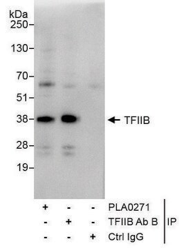 Rabbit anti-GTF2B/TFIIB Antibody, Affinity Purified