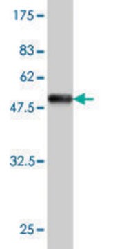 Monoclonal Anti-VSNL1 antibody produced in mouse clone 2F1-E3, purified immunoglobulin, buffered aqueous solution