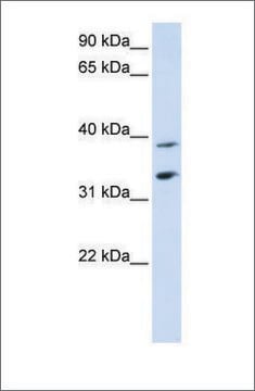 Anti-SLC25A34 antibody produced in rabbit affinity isolated antibody